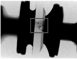 图2 二极管X光透射与电镜扫描分析图